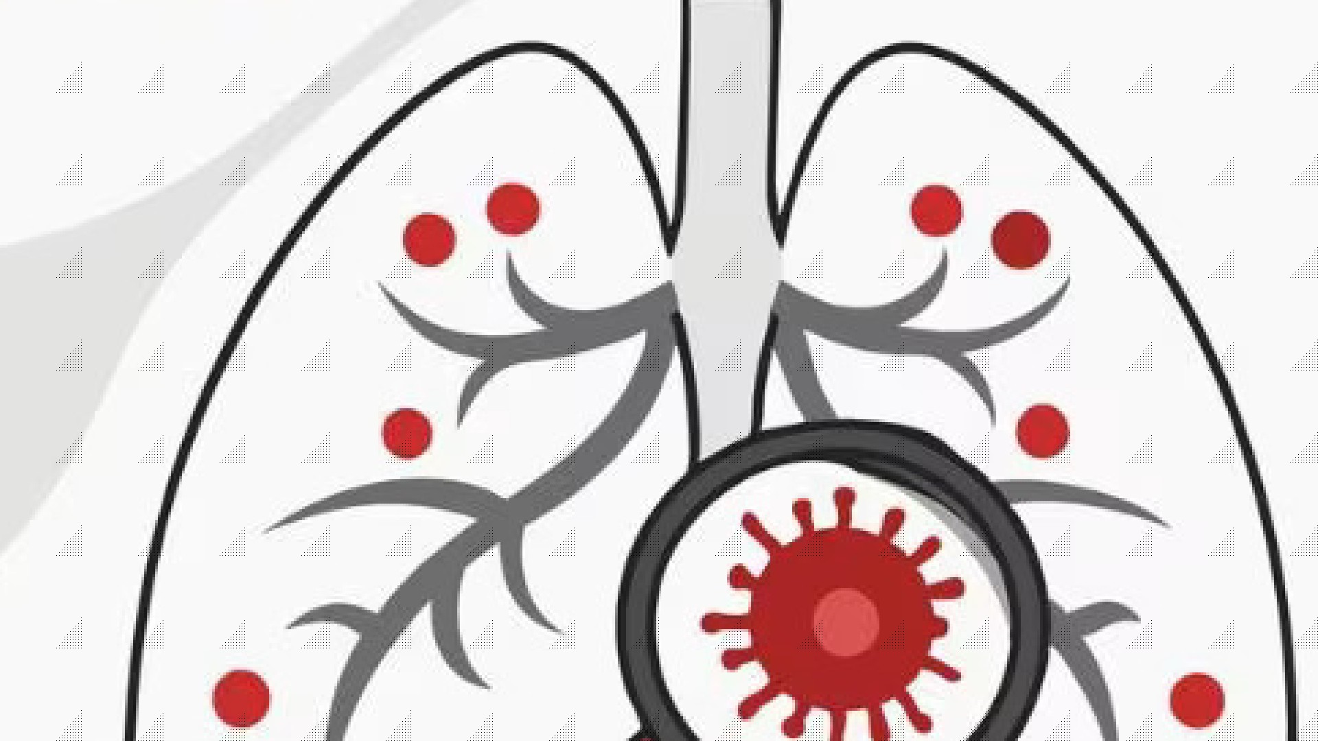 Tuberculose : la plaidoirie de MSF pour des financements durables 